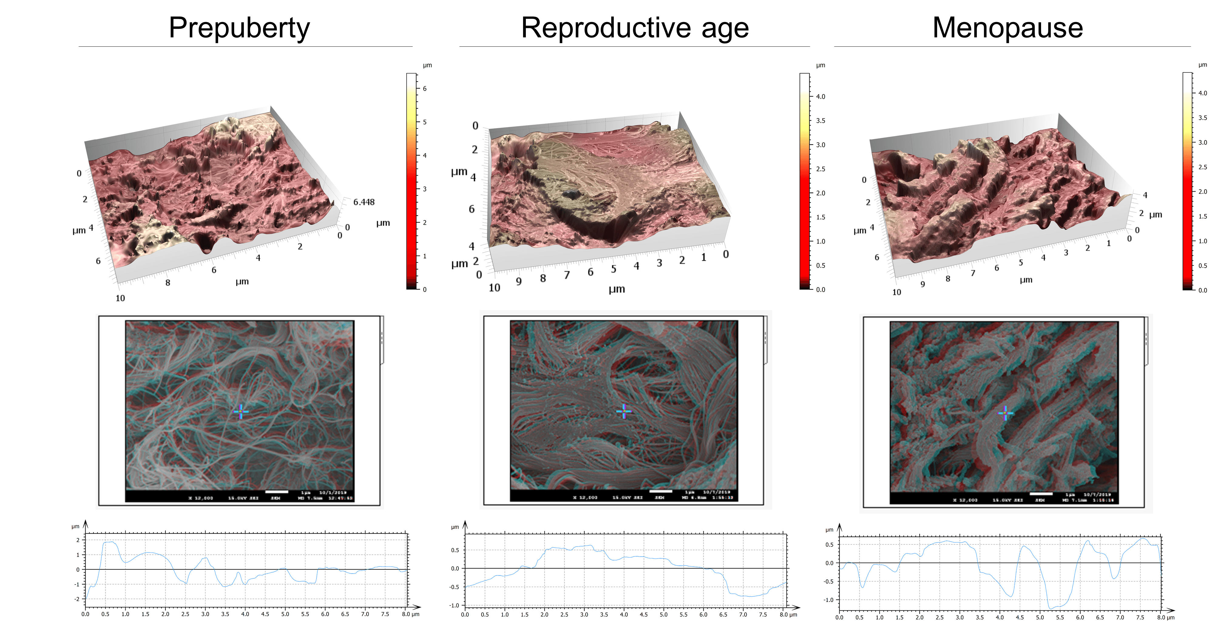 3D rendering surface topography from stereoscopic reconstruction of SEM images