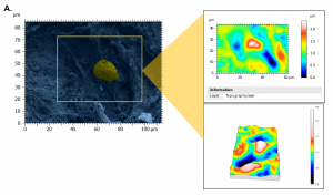 topography of perifollicular ECM reproductive age